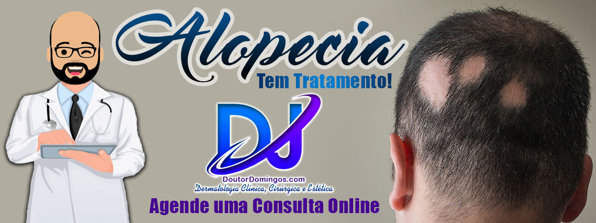 Banner - Alopecia