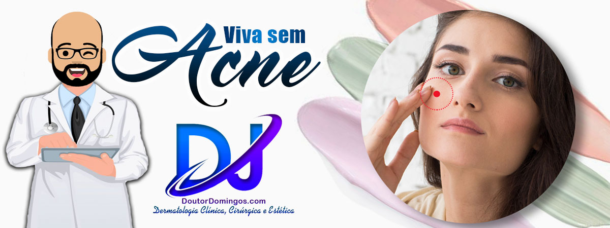 Banner - acne